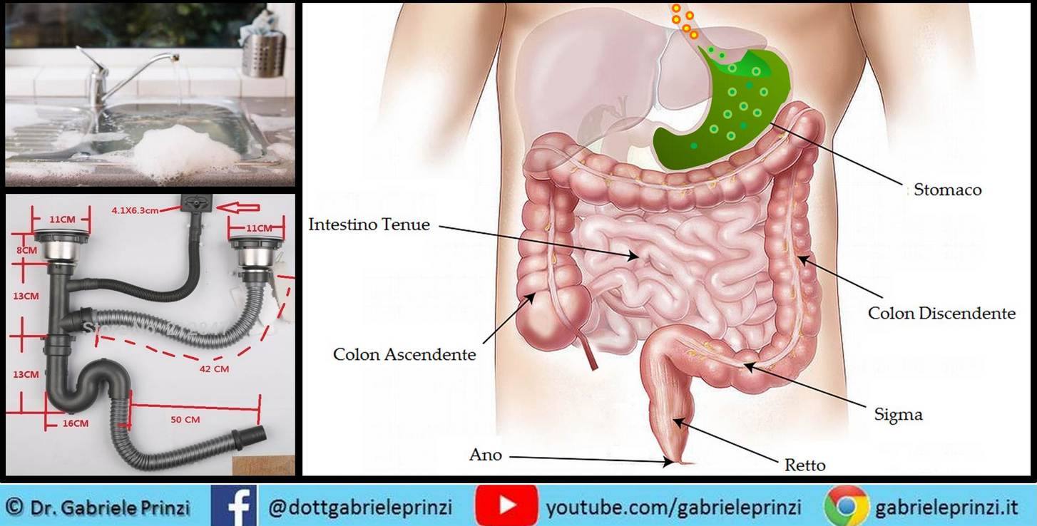 GASTRITE, REFLUSSO E L' IDRAULICO "DI MIO CUGGGINO"