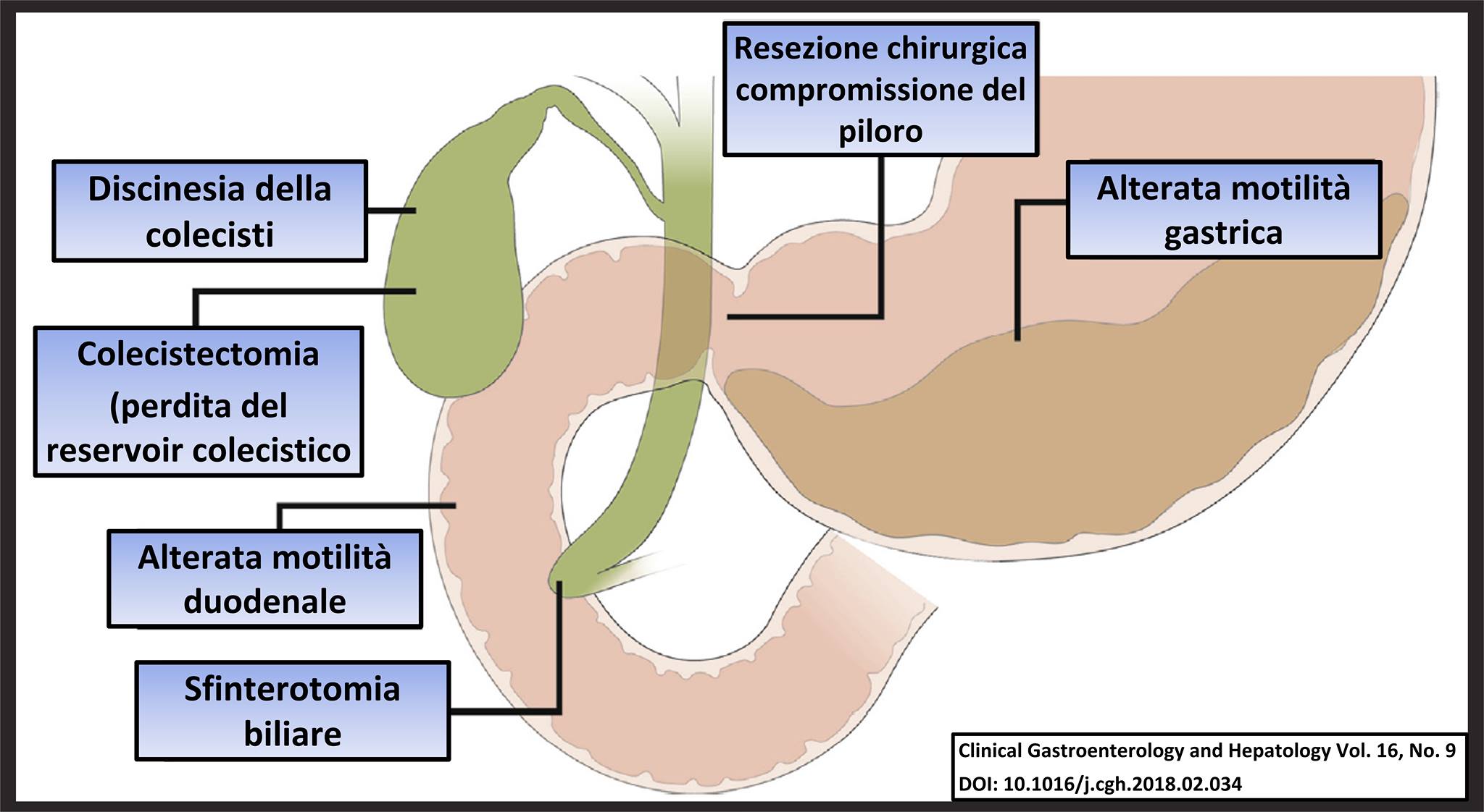 PRIMO COMANDAMENTO DELLA GASTROENTEROLOGIA: NON AVRAI ALTRA GASTRITE AL DI FUORI DI QUELLA ACIDA.